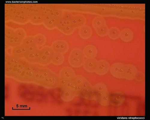 blood agar alpha hemolysis